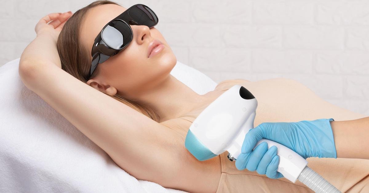 LASER HAIR REMOVAL